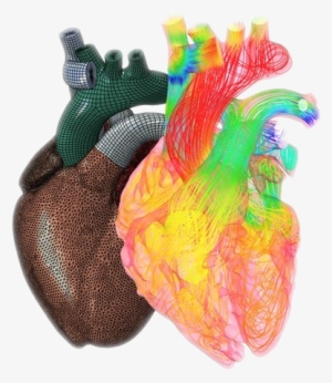 A Research Initiative To Revolutionize Cardiovascular - Application Of Cfd In Biomedical