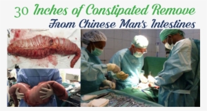 30 Inches Of Constipated Remove From Chinese Man's - Does The Intestines Look With Constipation