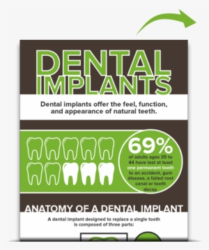 Dental Implants Muncie - Dental Implant Offers