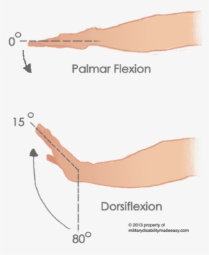 Wrist 3 - Dorsiflexed Wrist