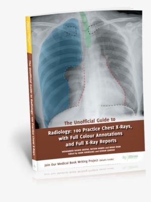 Buy The Unofficial Guide To Radiology - Unofficial Guide To Radiology: 100 Practice Chest X-rays,