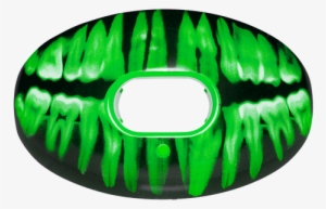 Mouthguard