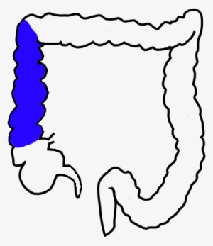 Cecum Of A Dog