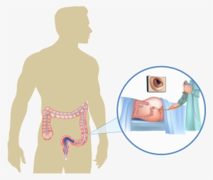 A Colonoscopy Is A Procedure That Examines The Colon - Colorectal Cancer