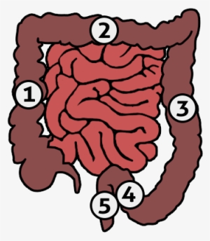 Human Colon - Different Types Of Ostomies And Locations