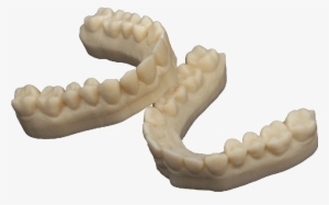 Dental Model By 3d Printing For Dental Crowns & Bridges - 3d Printed Dental Model