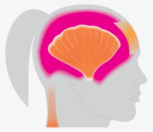 2w2111 Migraines - Migraine