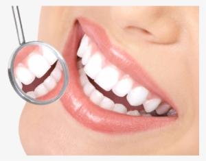We Carry Out New Dental Aesthetic Treatments Designed - Dental Care Png