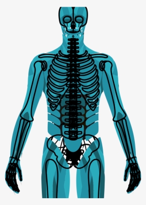 Muscular/skeletal - Muscle