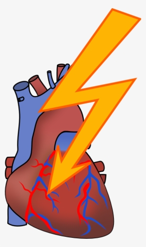 Heart - Heart Attack Clipart Png