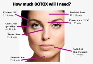 Image Result For Botox Injection Sites Chart