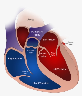 The Human Heart Has Four Valves - Severely Dilated Left Atrium