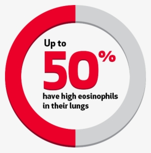 Up To 50% Of People With Severe Asthma Have High Eosinophils - Asthma