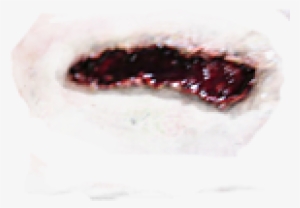 Wound Png Free Download - Wound