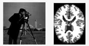 Original Images 'cameraman' And Phantom Of A Brain - Monochrome