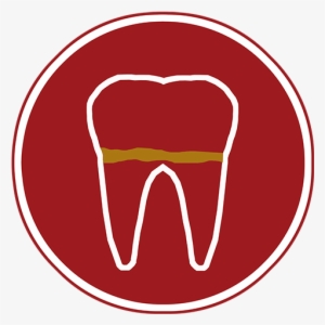 Gum Disease - Tooth