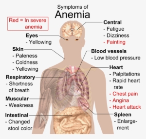 Blood Disorders - Anemia - Know If You Re Anemic