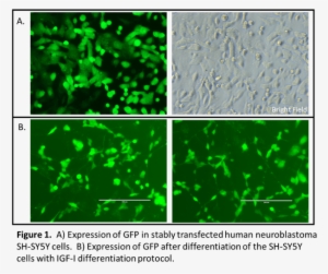 sh-sy5y cells showing gfp expression - sh sy5y
