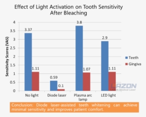 Teeth Sensitivity Of After Laser Whitening - Tooth Whitening
