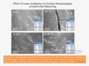 Surface Morphologies Of Teeth After Laser Whitening - Laser