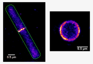 Super-resolution Microscopy