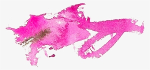 Pink Splotch - Illustration