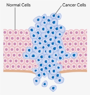 Cancer Basics - “ - Crecimiento De Celulas Cancerosas