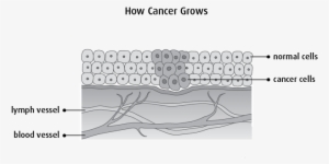 Diagram Of How Cancer Grows - Diagram