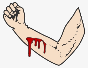 Bloody-arm - Arm