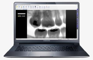 Easily Invert An Entire Image With Just A Click Of - Netbook