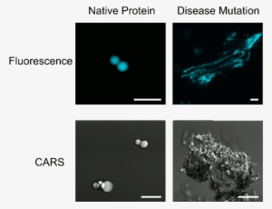Native And Disease Mutated Rnp Granule Proteins - Micrometre