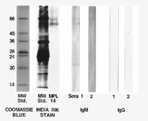 Showing The Different Patterns Of Staining Of The Molecular - Monochrome