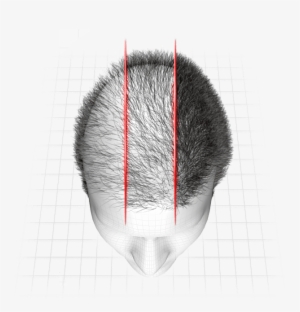 A Fase 3 Do Hairloss Blocker Funciona Começando A Revitalização - Mitos E Verdades Sobre Cabelos