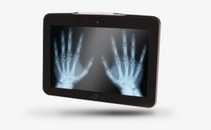 Md101 - X Ray