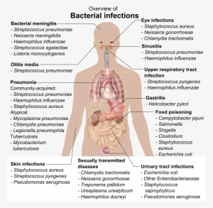 Bacterial Infections And Involved Species - Overview Of Bacterial Infections