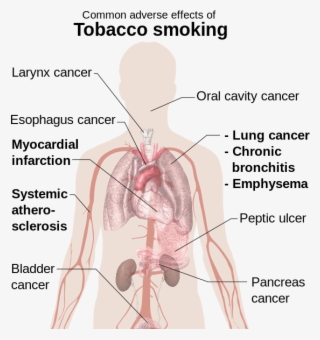 Effects Of Smoking - Common Adverse Effects Of Tobacco Smoking