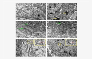 Autophagosomes Existed In Both Control And Diabetic - Hippocampus Ultrastructure