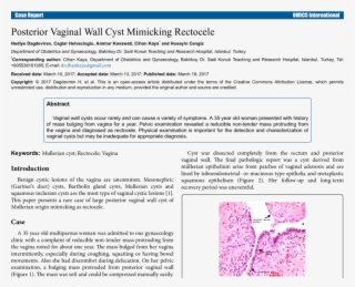 Histopathologic Findings Of Vaginal Cyst - Vaginal Cysts