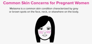 Here Are Some Of The Most Common Skin Concerns That - Cartoon