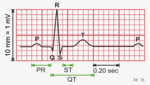 Electrocardiogram Durations And Intervals - Electrocardiography