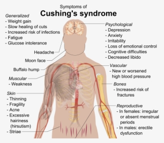 diseases of the hypothalamus pituitary adrenal axis - cushing syndrome