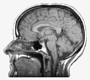Brain - Brain Scan Transparent Background