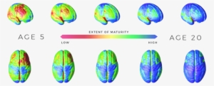 Extent Of Maturity - Maturity Stages Of Brain