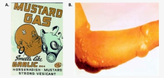 1 Use Of Mustard Gas During World Wars I And Ii - Chemical Warfare Ww1 Propaganda