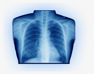 Avoid The Hospital Hassleaffordable X-rays In As Little - Download