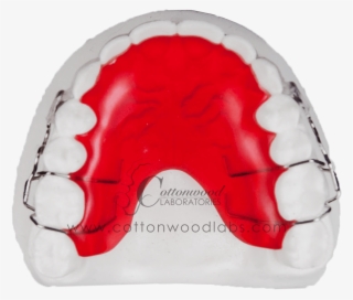 Clear Labialhawley - Arch