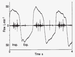 Signals) Of The Breath Sounds Of A Patient With Fibrosing - Respiratory Sounds