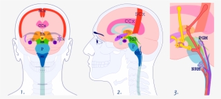 Images 1 And 2 Show The Brainstem's Medulla Oblongata,