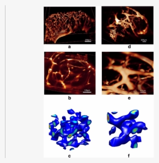 Alterations Of The 3d Self-organized Vmc Multicellular