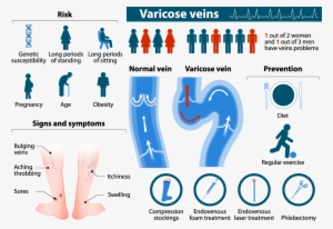 varicose veins infographic web - risk factor of varicose vein